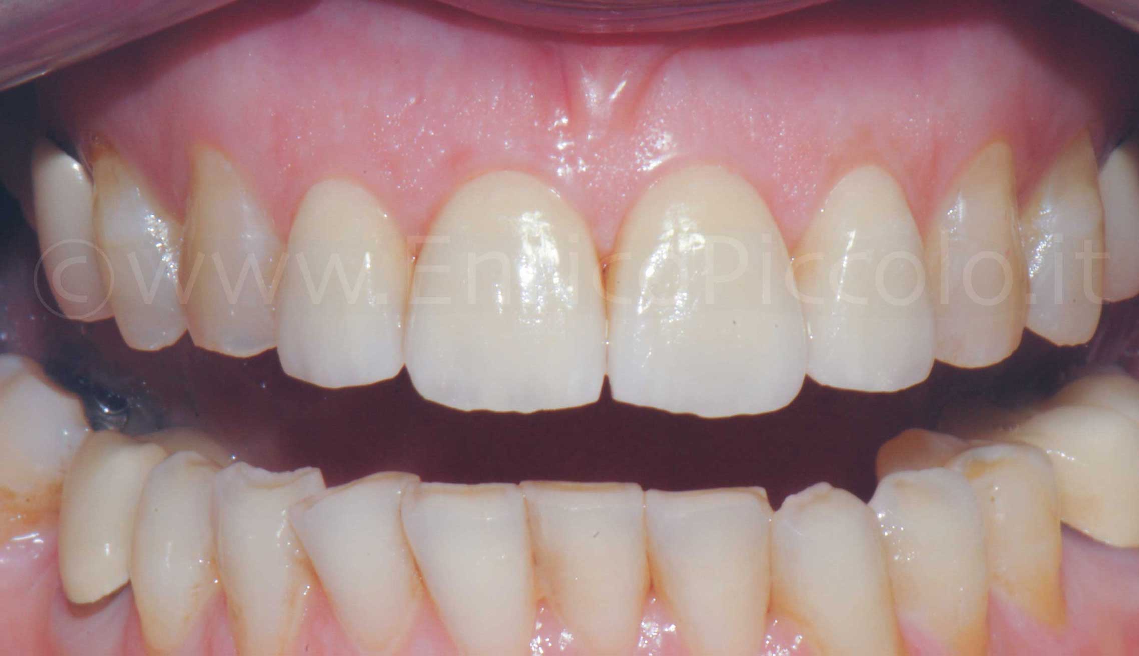 After image