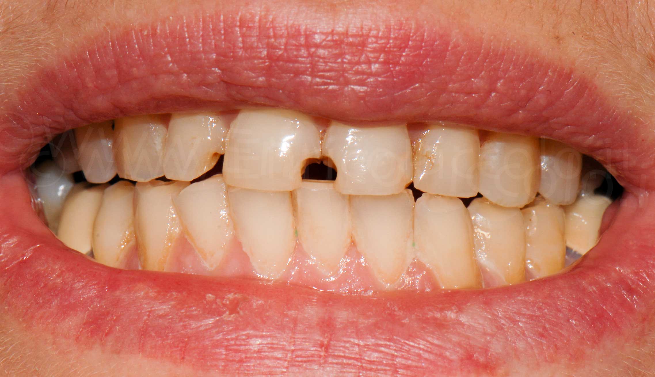 Before image