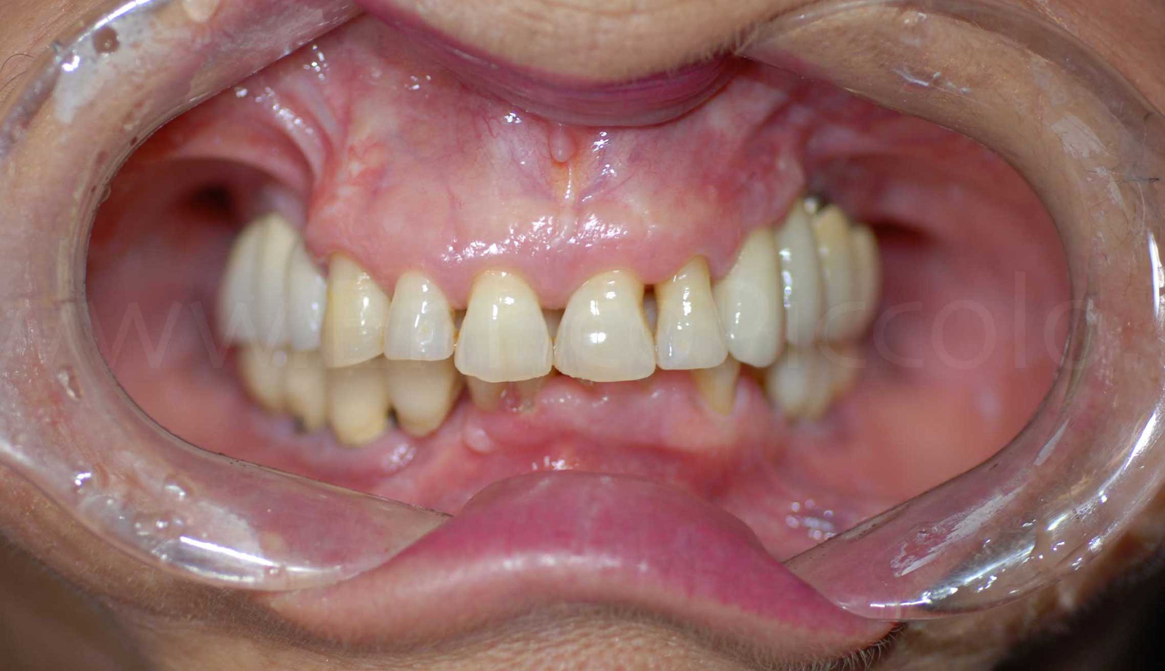 Before image