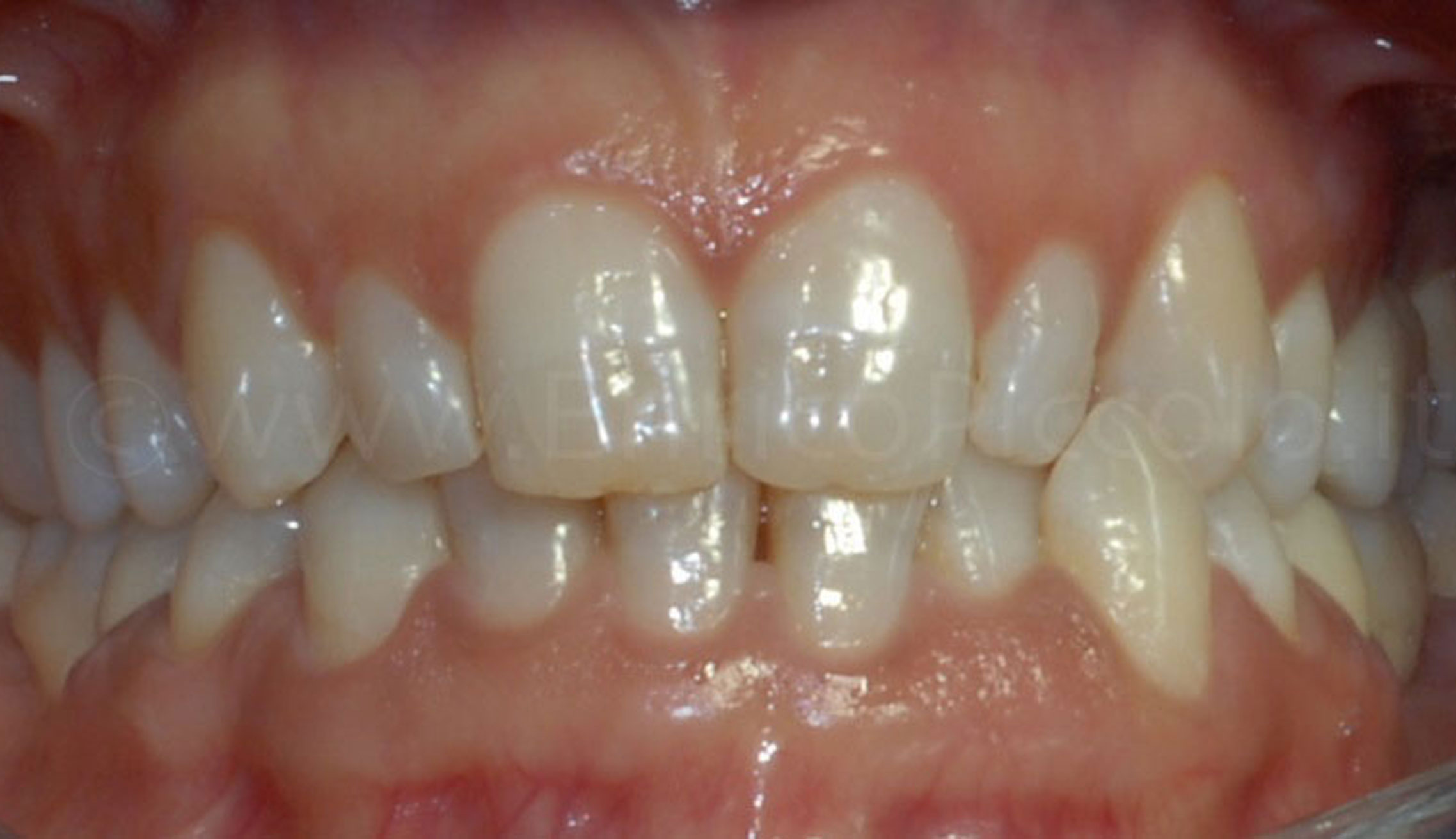 Before image