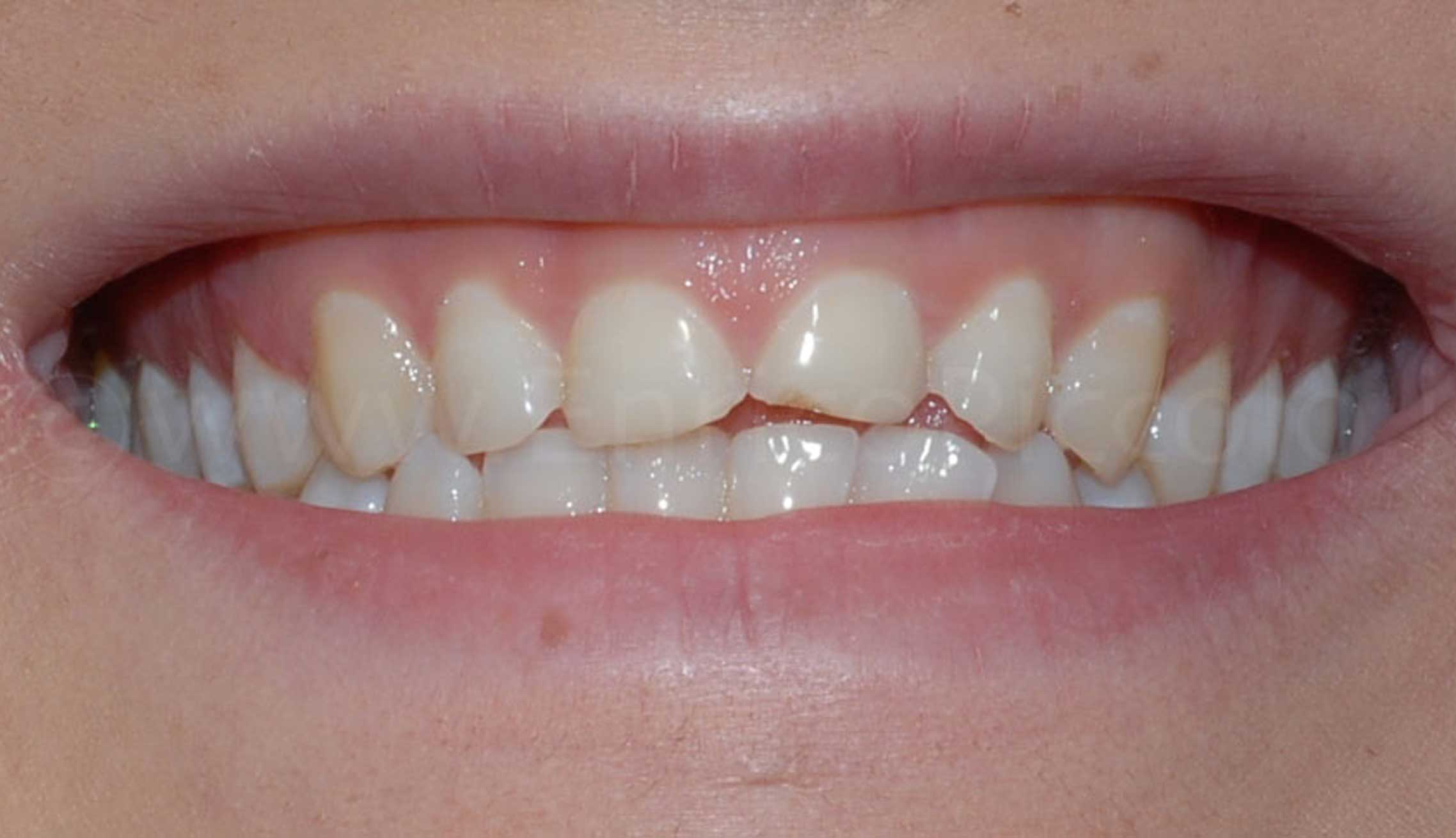 Before image