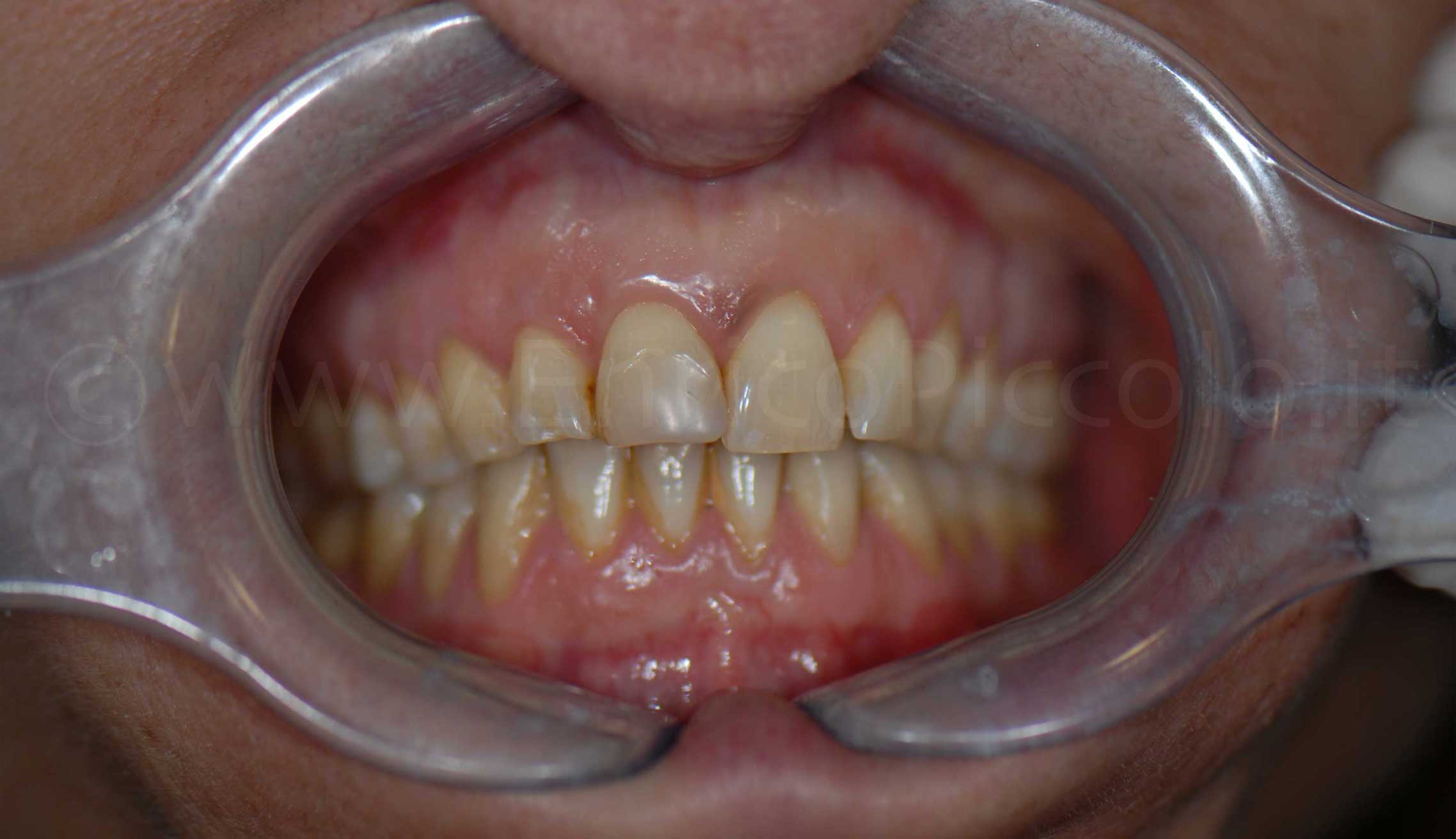 Before image